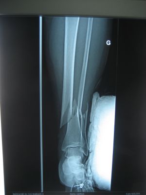 xray